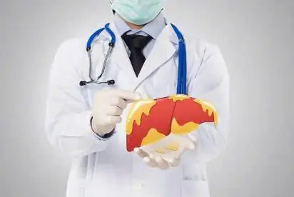Fatty Liver Disease: 6 Warning Signs You Should Never Ignore