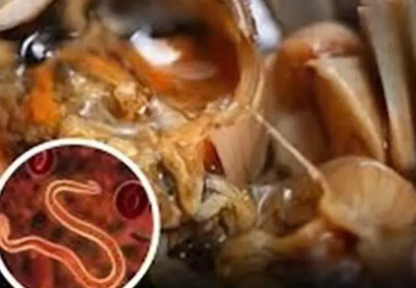 Health Alert from Doctors: These 4 foods are full of parasites cssa