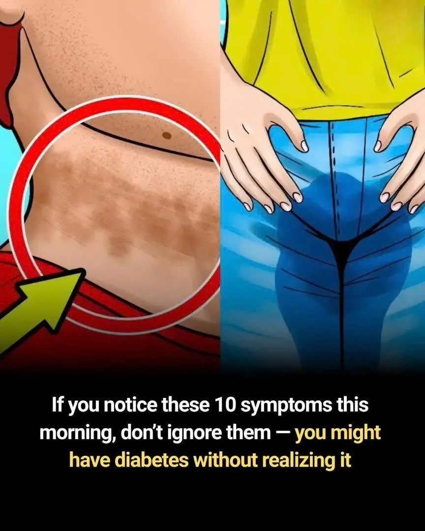 Your Body May Be Whispering About Diabetes — Watch for These 10 Symptoms