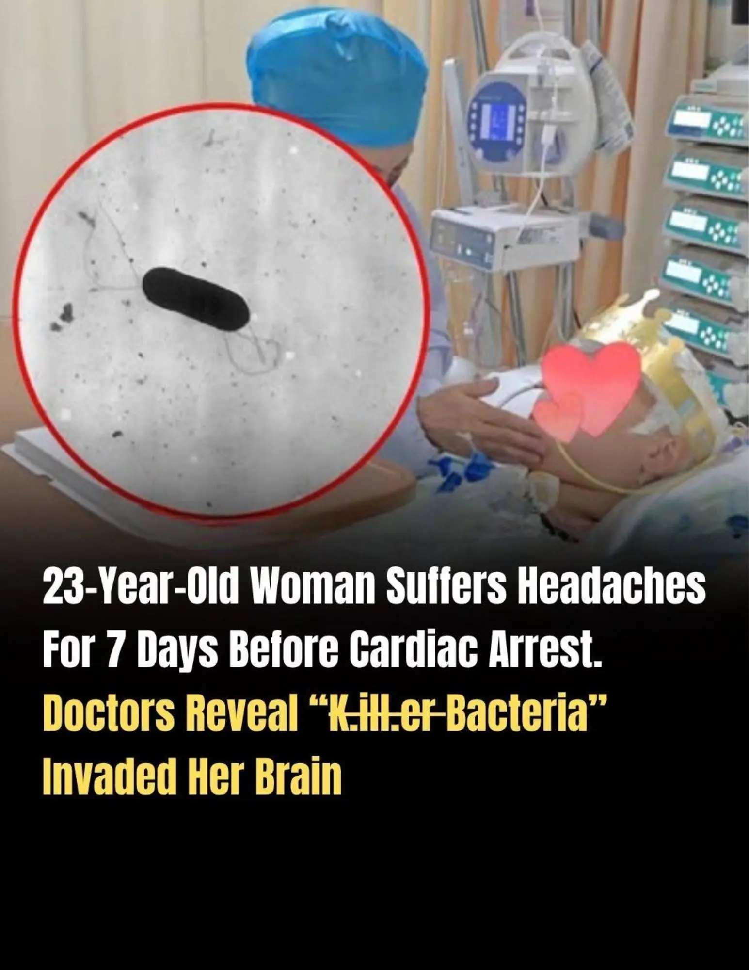 A Week of Headaches: Warning Signs of a Rare but Serious Brain Infection