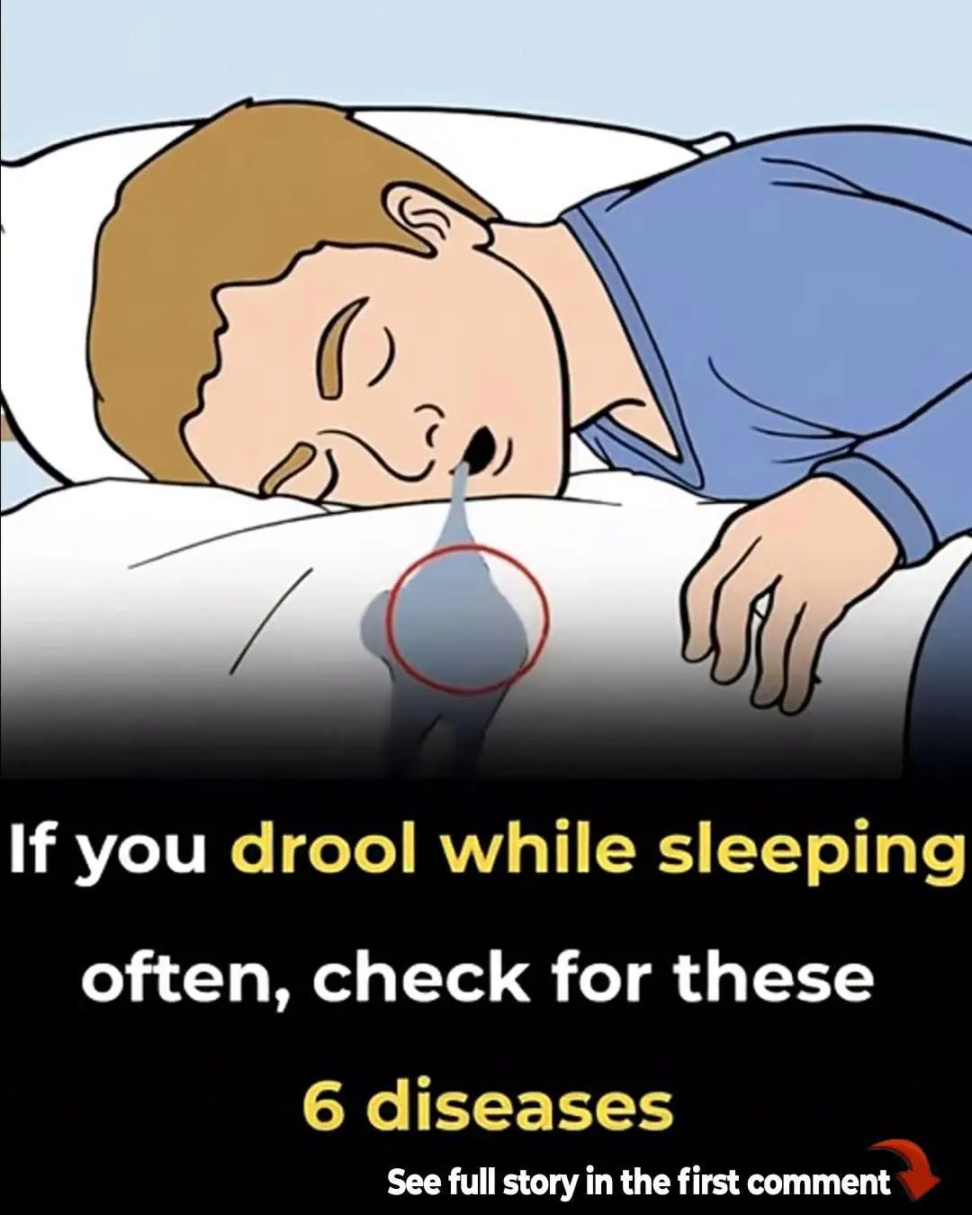 What Causes Excessive Drooling at Night? Here Are 6 Potential Explanations