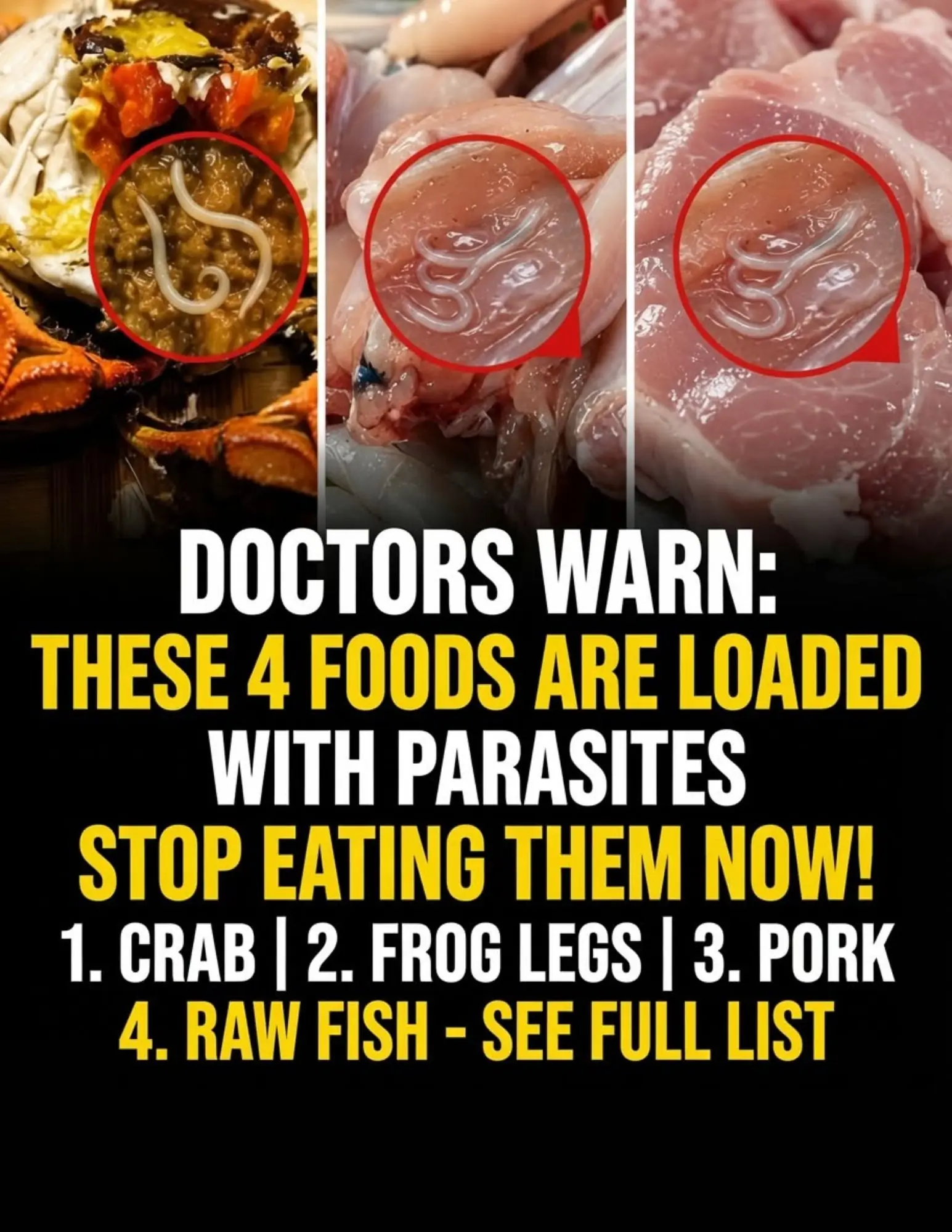 Doctors Warn: Stop Eating These 4 Foods Immediately—They May Carry Hidden Parasites That Put Your Health at Risk