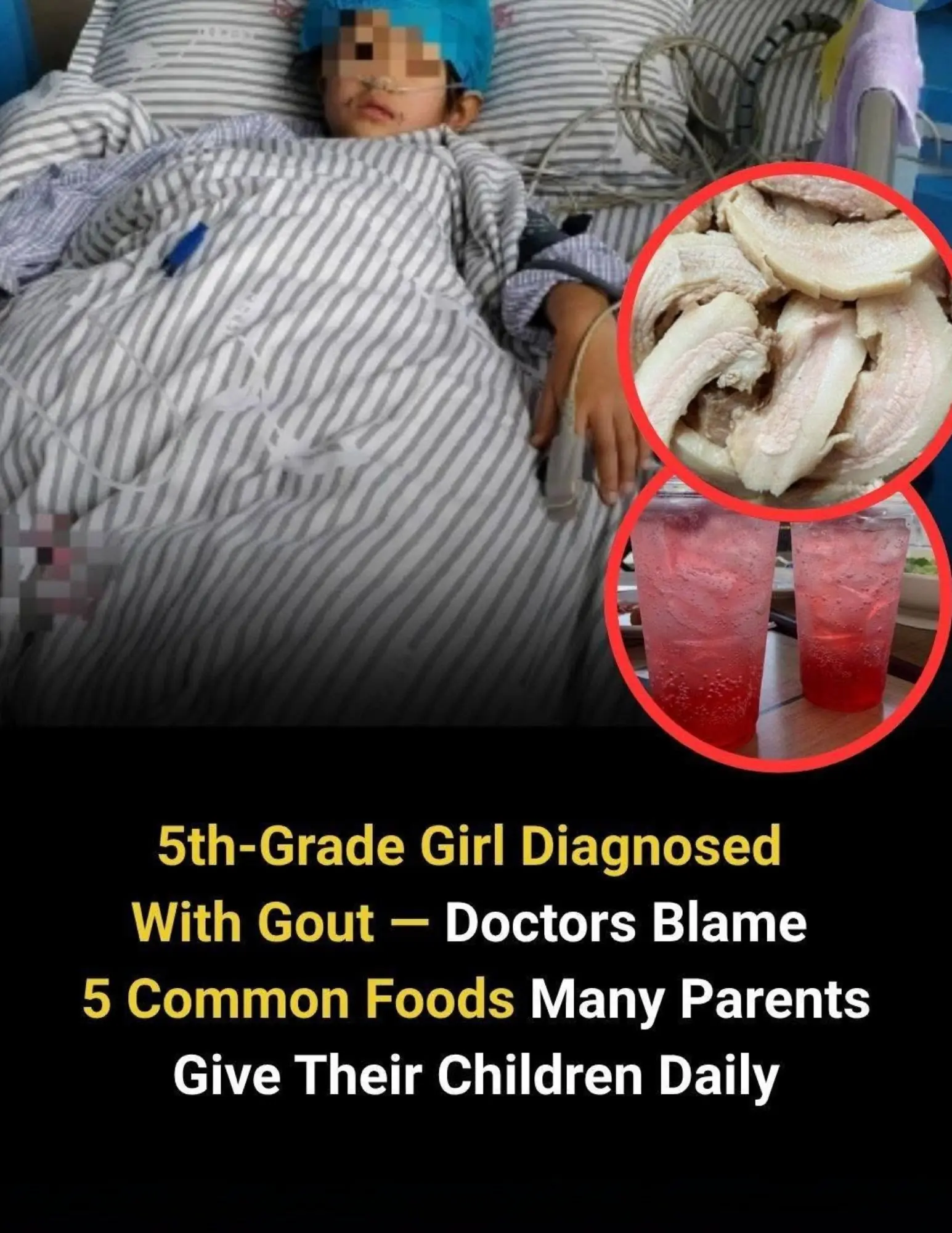 5th-Grade Girl Diagnosed With Gout — Doctors Blame 5 Common Foods Many Parents Give Their Children Daily