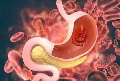 Early Detection Matters: 8 Symptoms That May Signal Can.cer in Older Adults