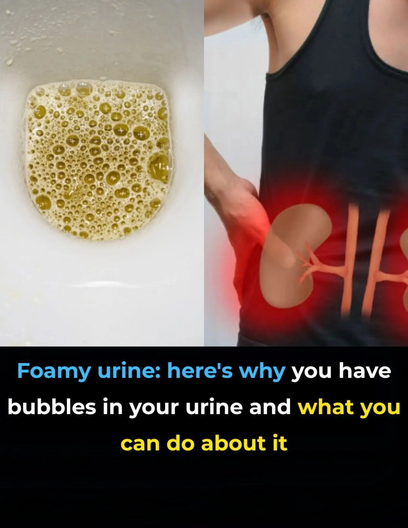 Foamy Urine: Here’s Why You Have Bubbles in Your Urine