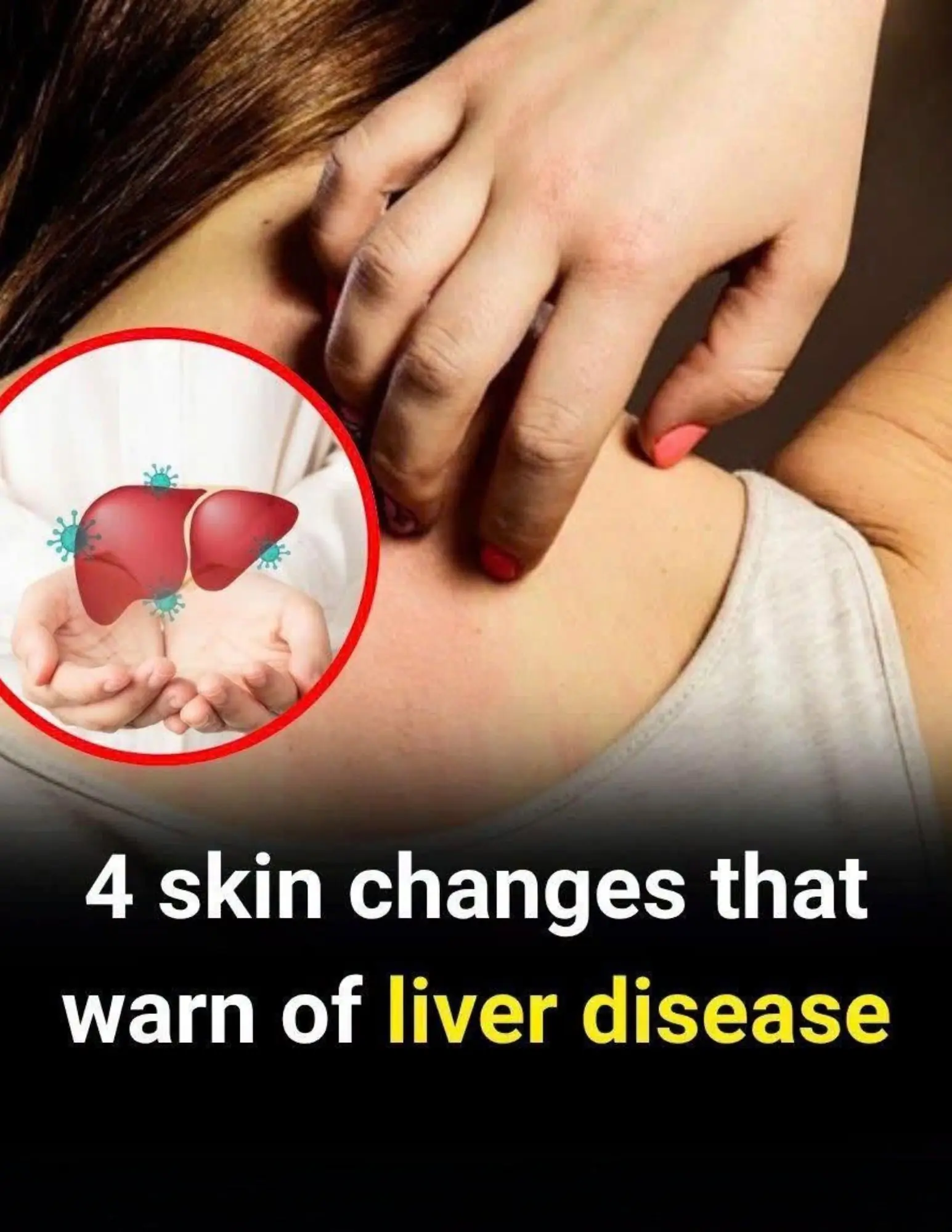 4 Skin Symptoms That Could Be Warning Signs of Liver Disease