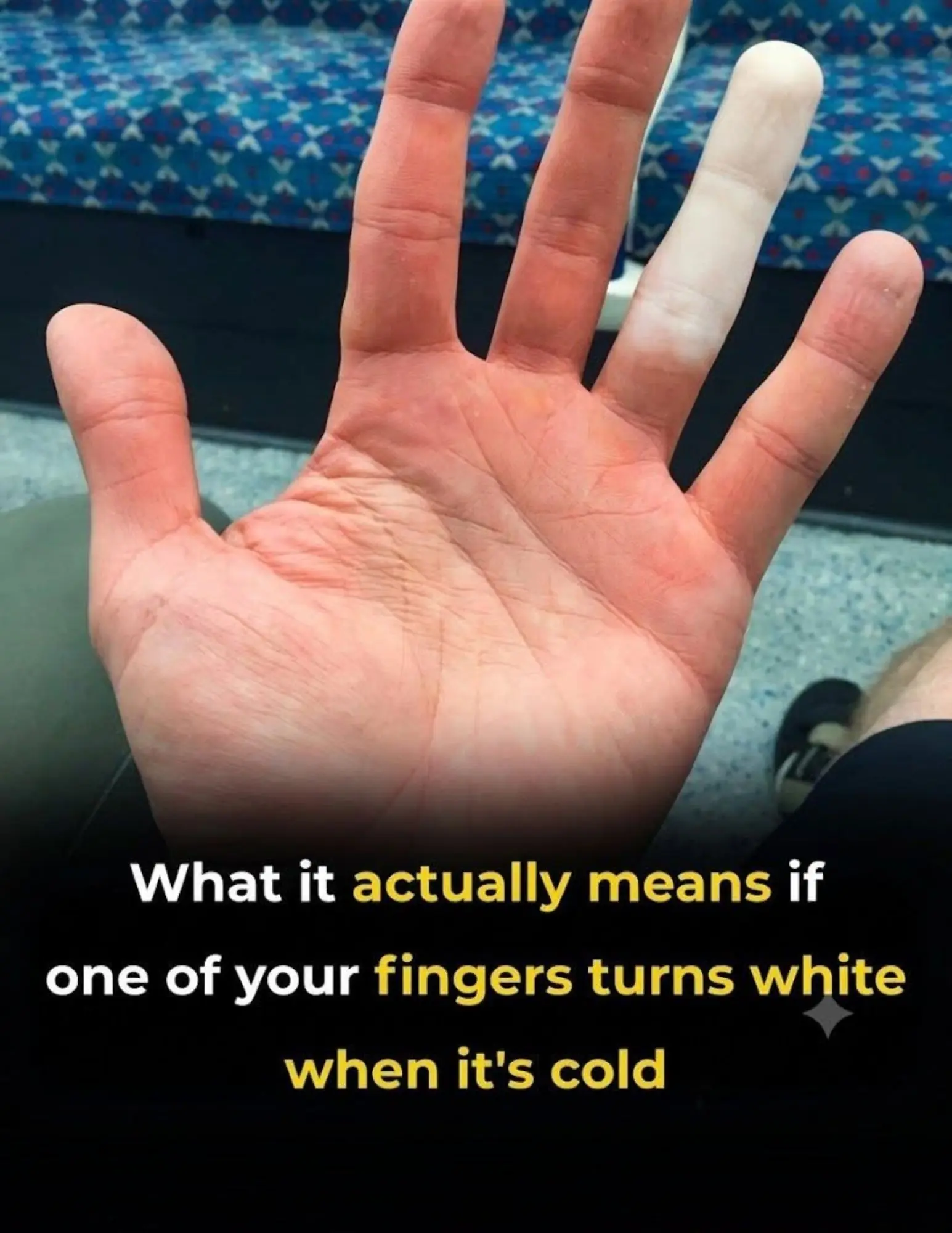 If Your Fingers Turn White in the Cold, Your Body May Be Warning You About Something