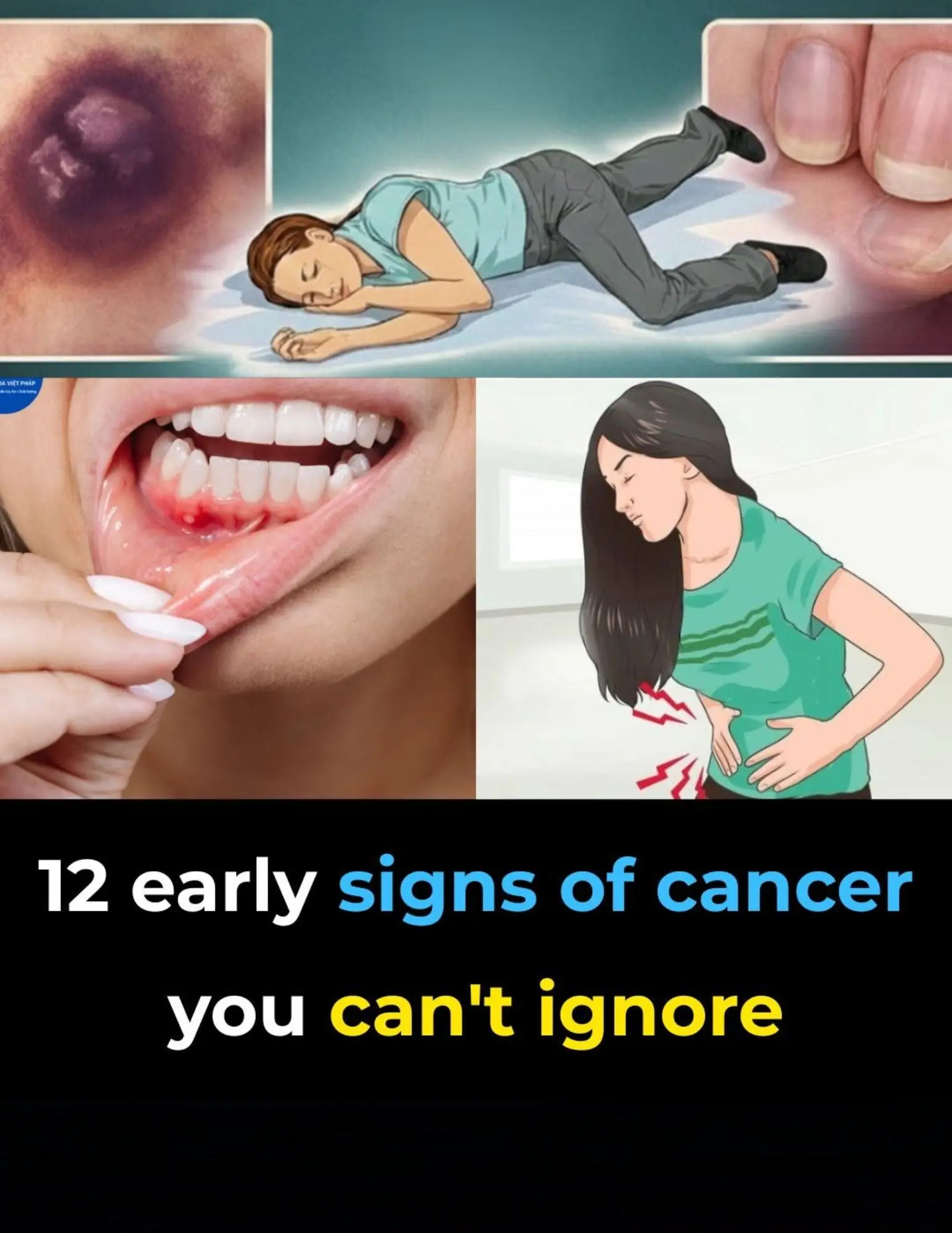 12 Early Warning Signs of Cancer You Should Never Ignore