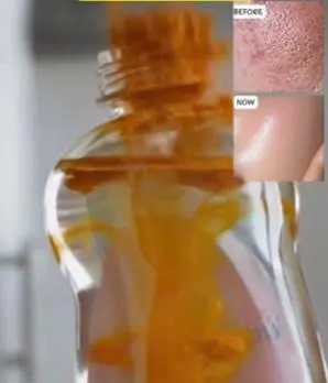 5 Best Herbal Clove Baby Oil Collagen Oils