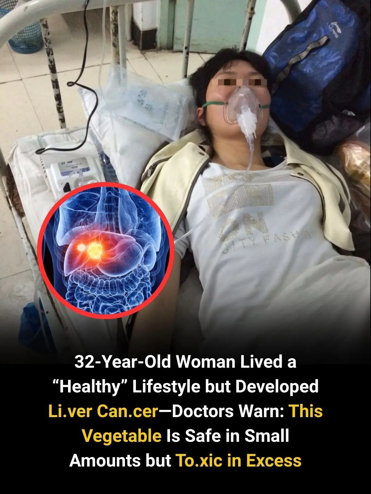 32-Year-Old Woman Lived a “Healthy” Lifestyle but Developed Li.ver Can.cer—Doctors Warn: This Vegetable Is Safe in Small Amounts but To.xic in Excess