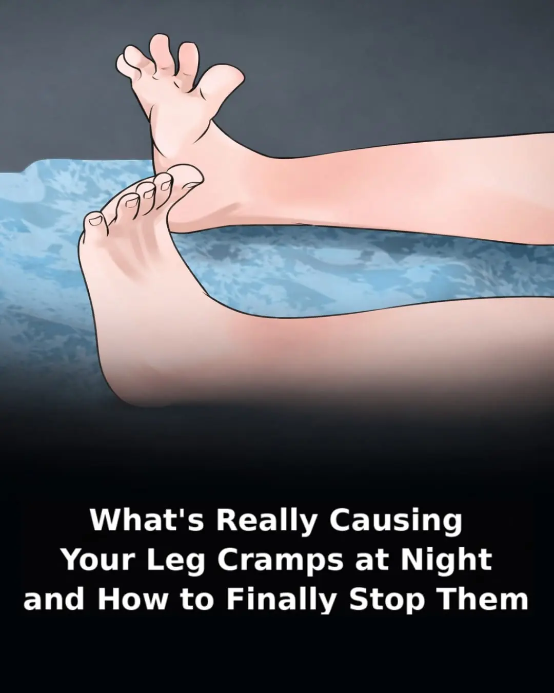 Leg Cramps at Night: Causes, Prevention & Treatment