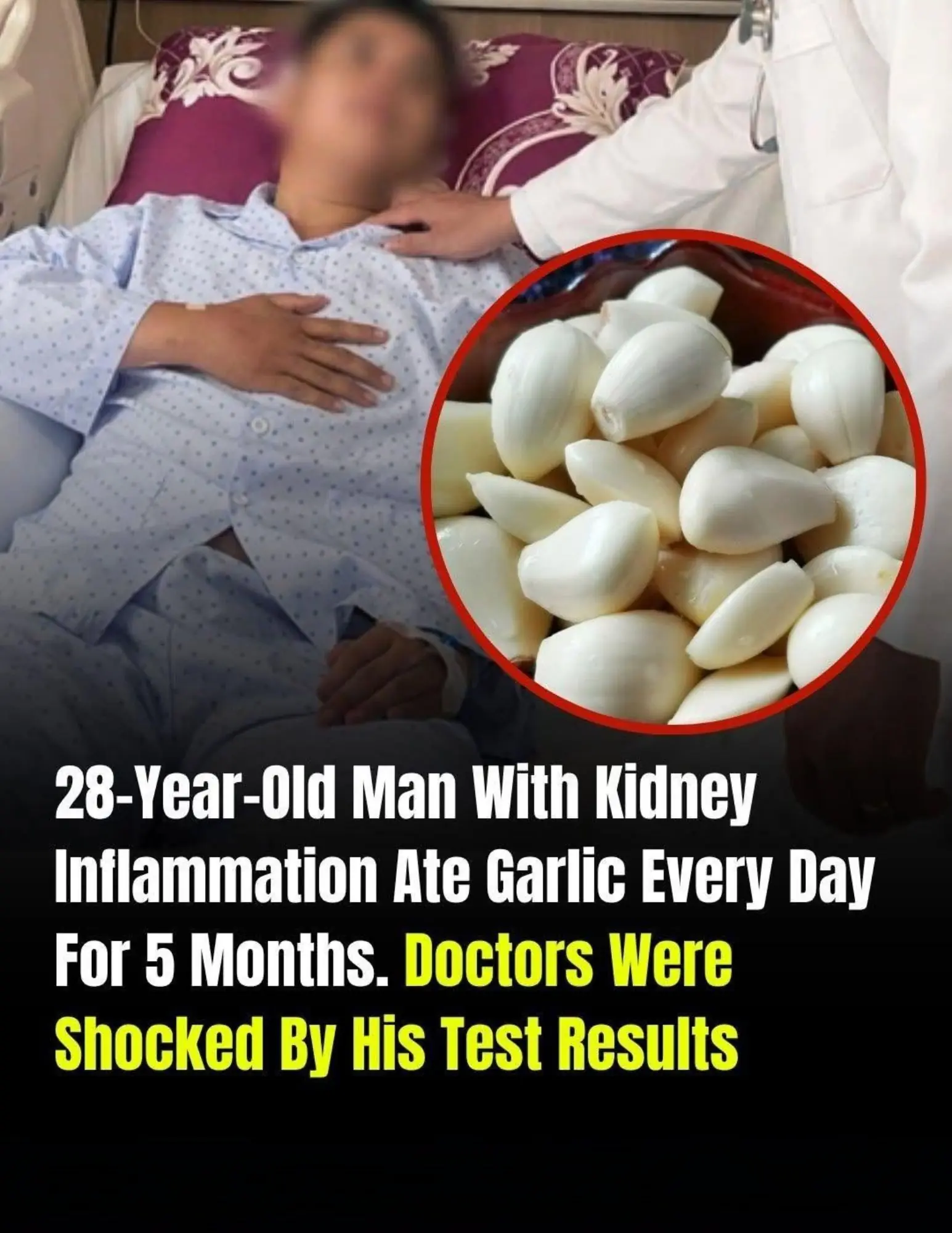 He Ate Garlic Every Day for 5 Months Hoping to Heal His Kidneys. What Happened Next Shocked Everyone.