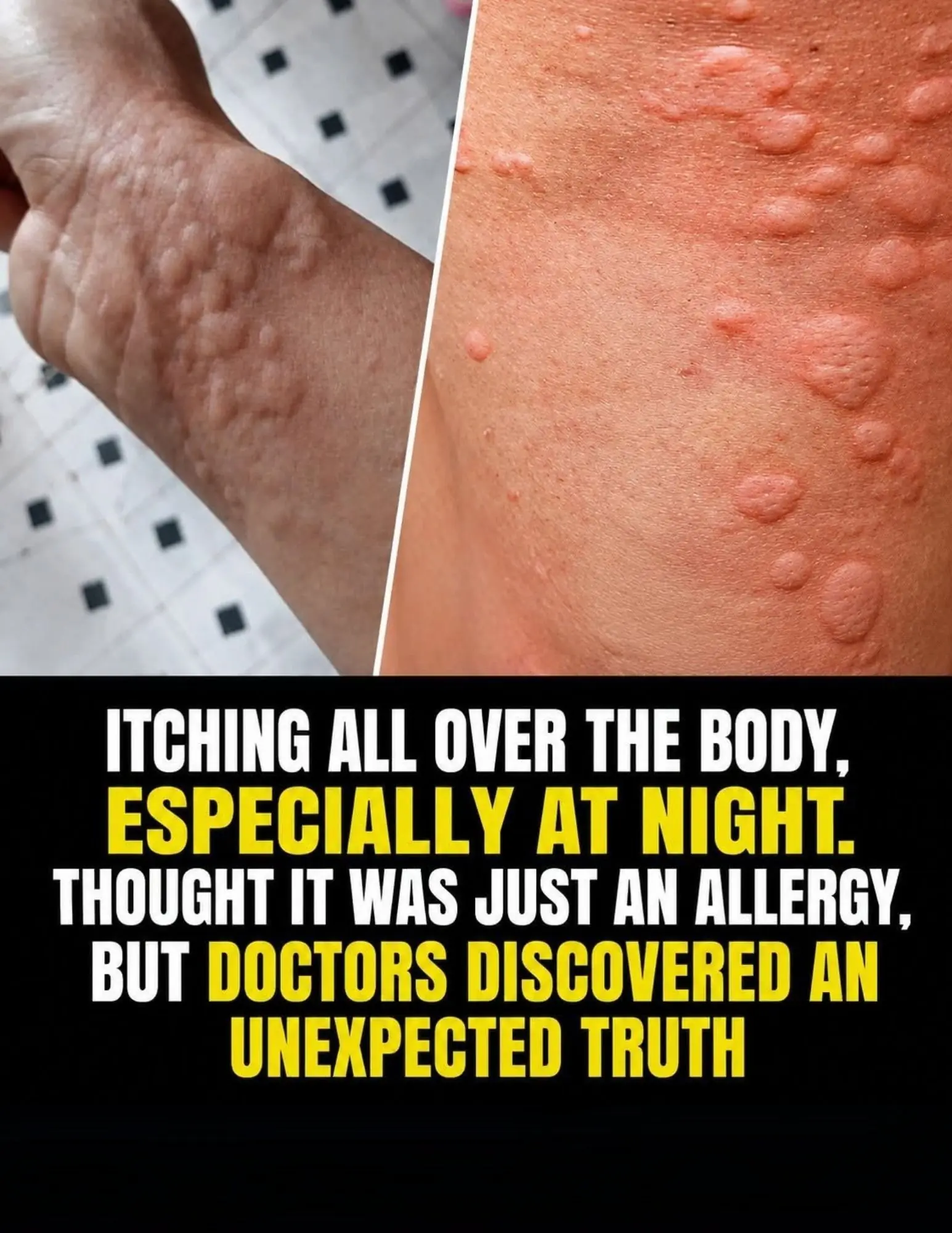 Persistent Itching All Over the Body, Especially at Night? It May Be More Than Just an Allergy