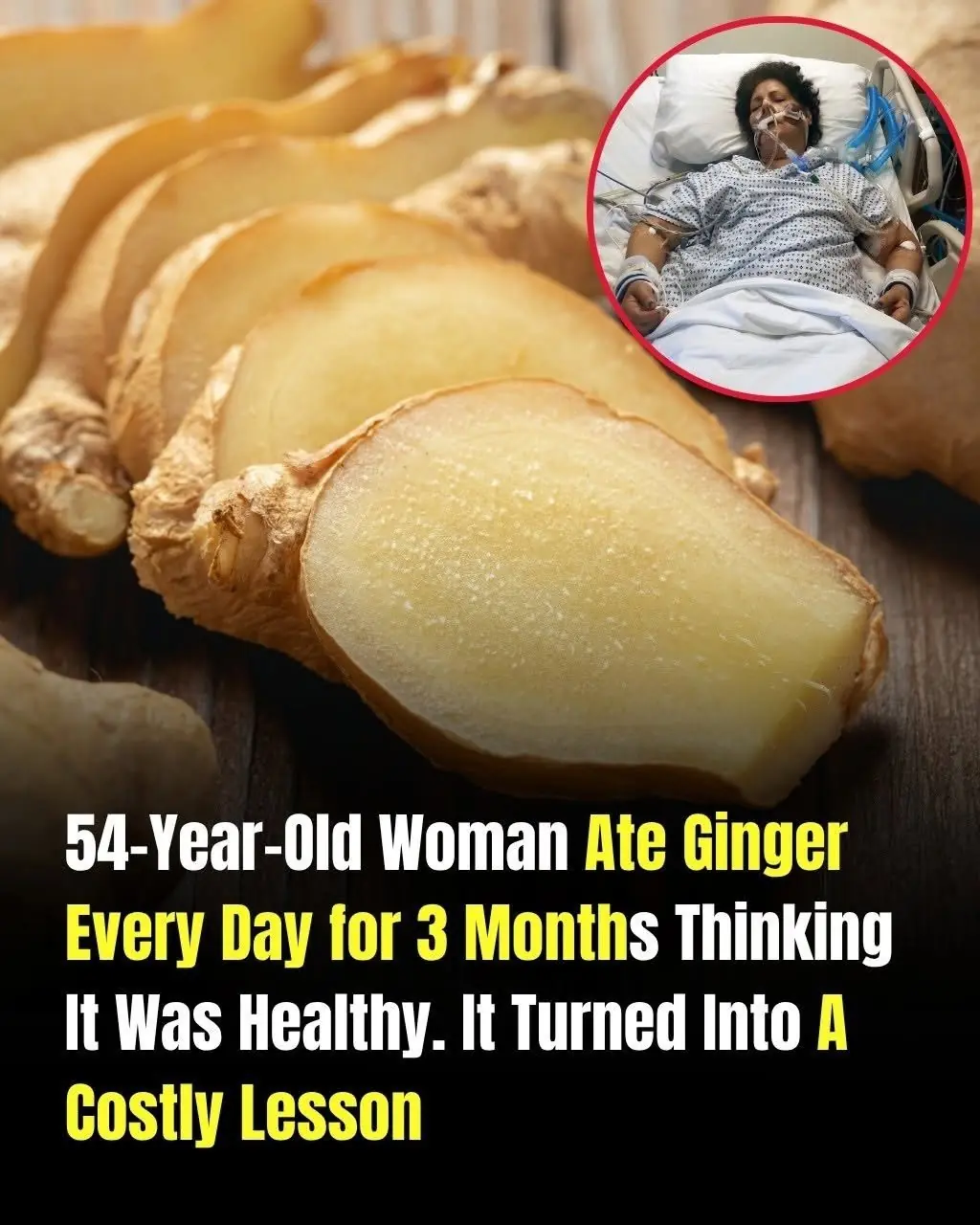 Doctors Warn: 3 Common Foods That May Put Extra Stress on Your Kidneys When Eaten Too Often