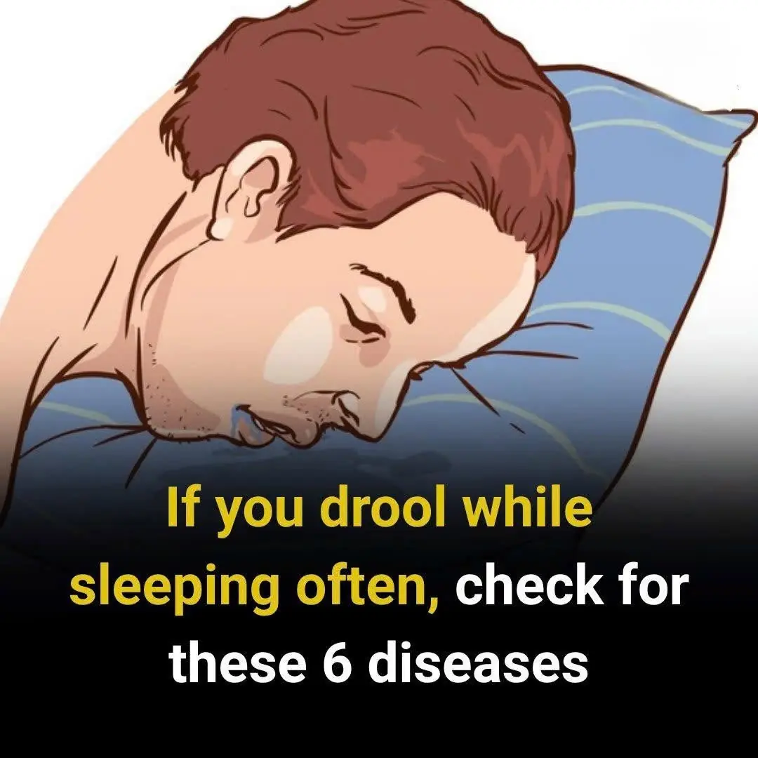 Why Do You Wake Up Drooling?