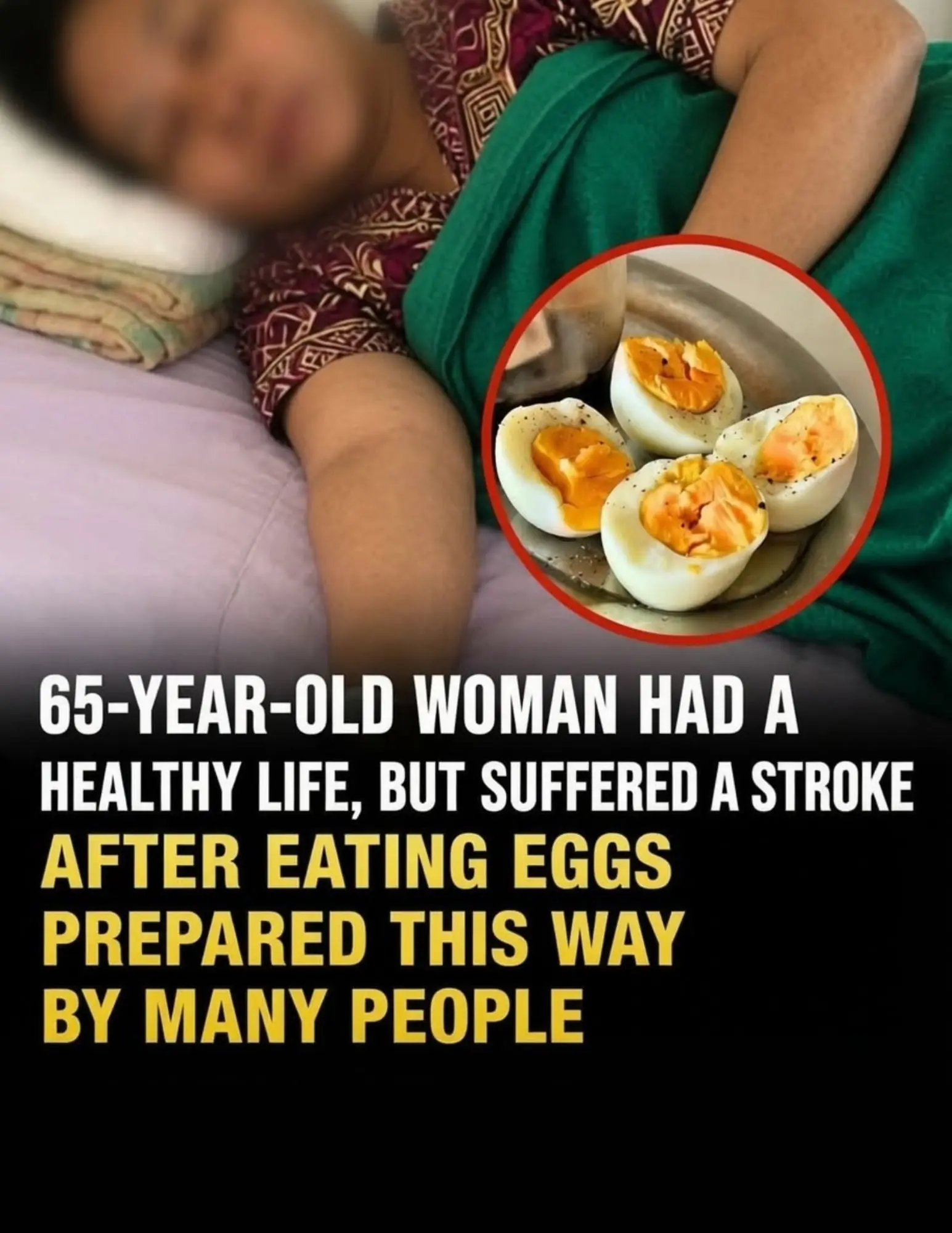 A 65-Year-Old Woman Suffered a Stroke After Eating Eggs This Way Every Day: The Hidden Food Safety Mistake Many People Overlook