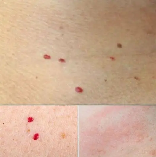 Red Dots On Your Skin