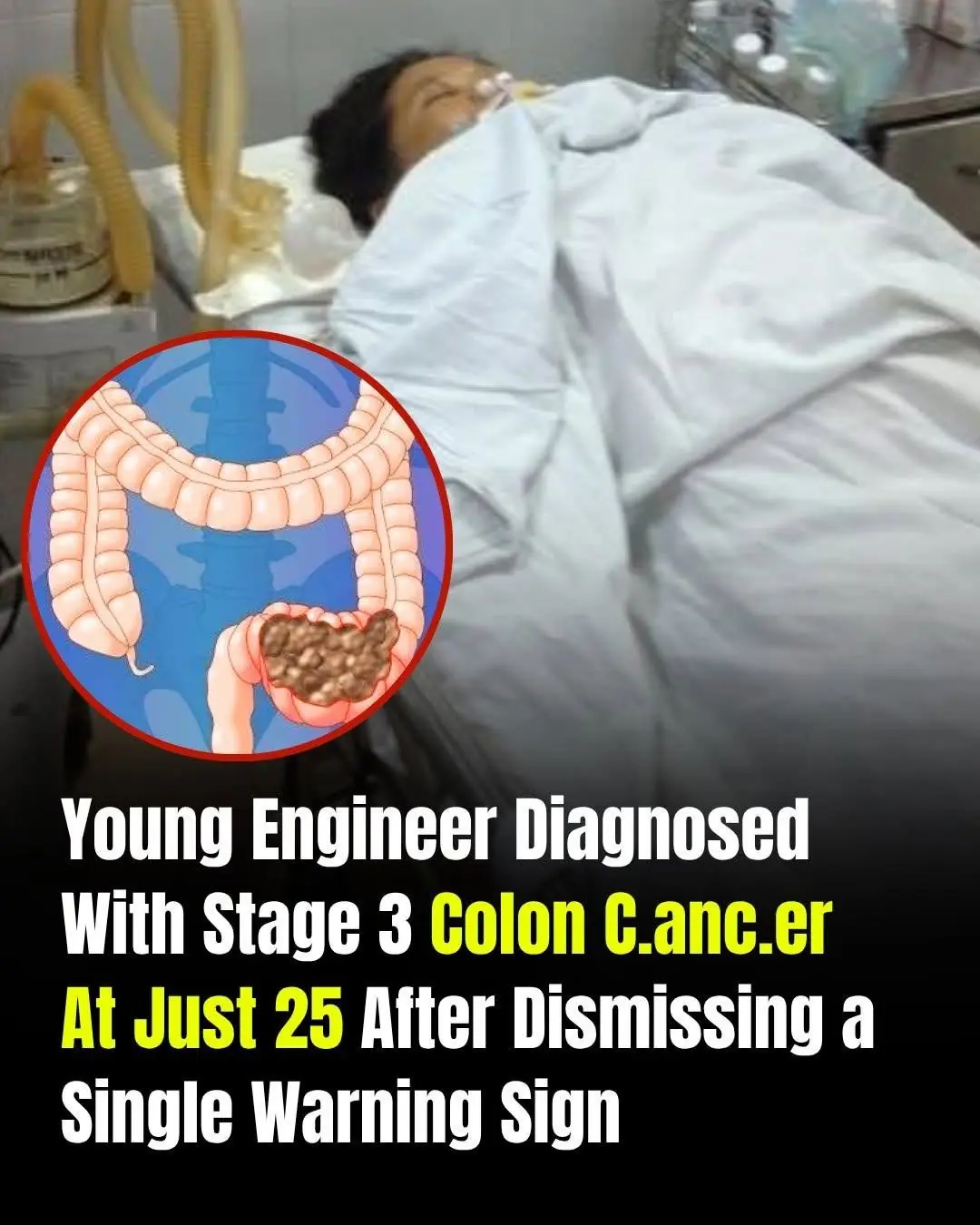 Young Engineer Diagnosed With Stage 3 Colon Can.cer at 25 After Ignoring One Warning Sign