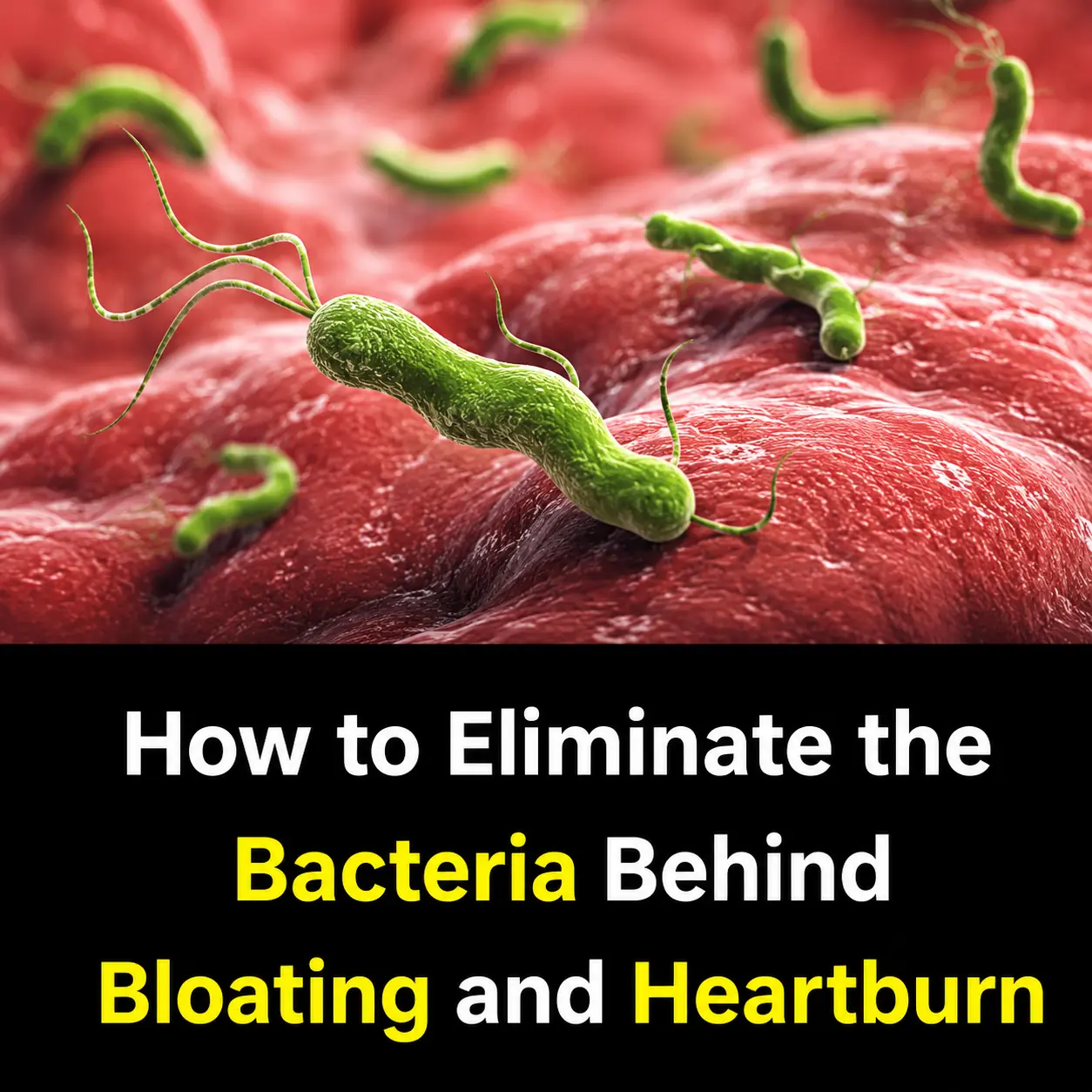 How to Treat H. Pylori (Helicobacter Pylori) Naturally Without Antibiotics