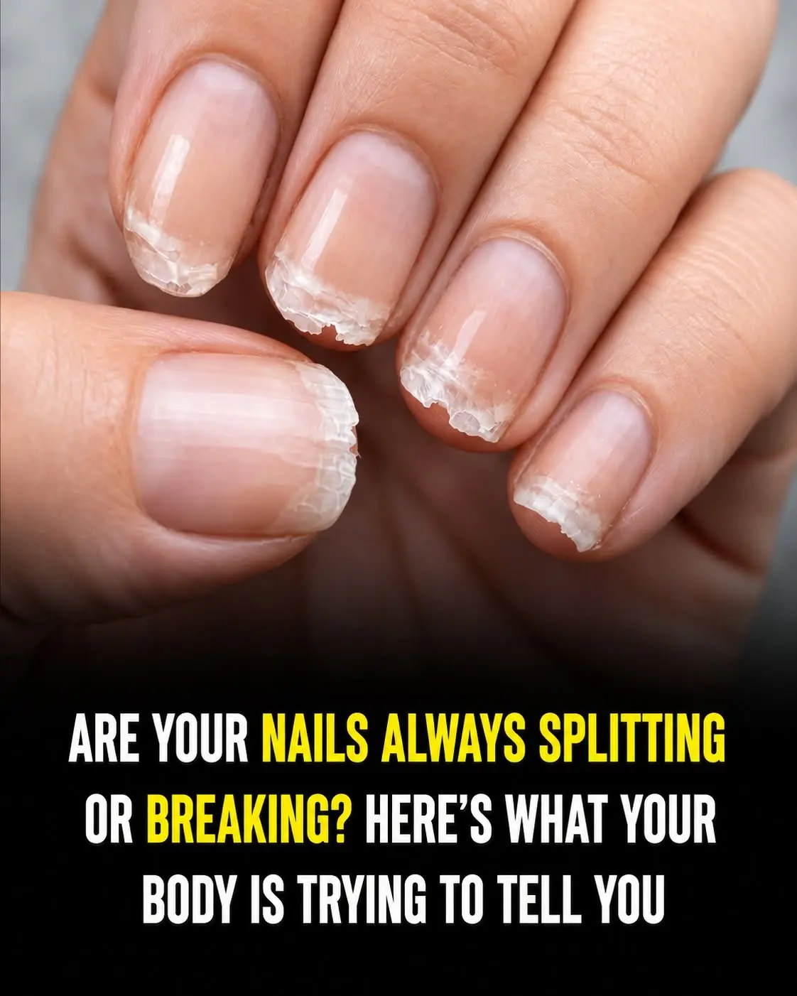 Brittle or Splitting Nails? Here’s What Your Body Might Be Trying to Tell You