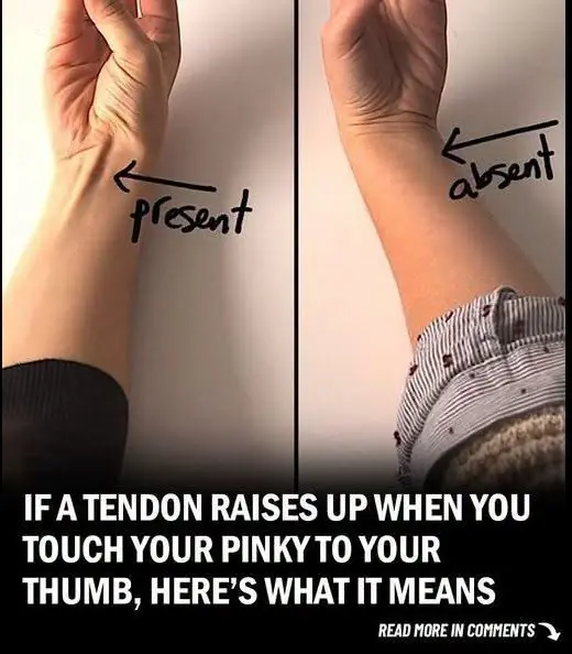 Connection Between Your Tendon and Evolution