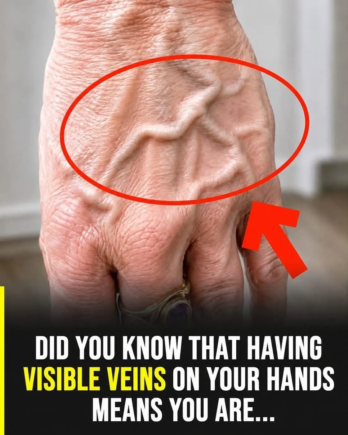 What Do Visible Veins on Your Hands Really Mean? Here's What Experts Say