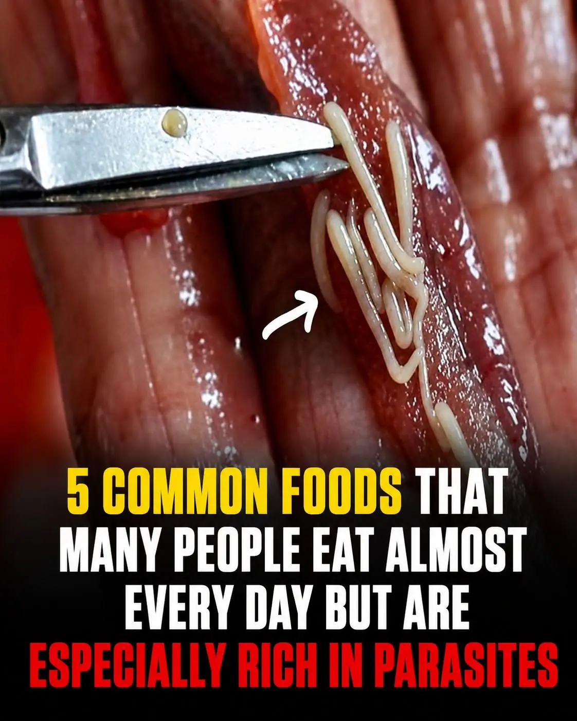 5 Common Foods That May Contain Parasites if Not Properly Prepared