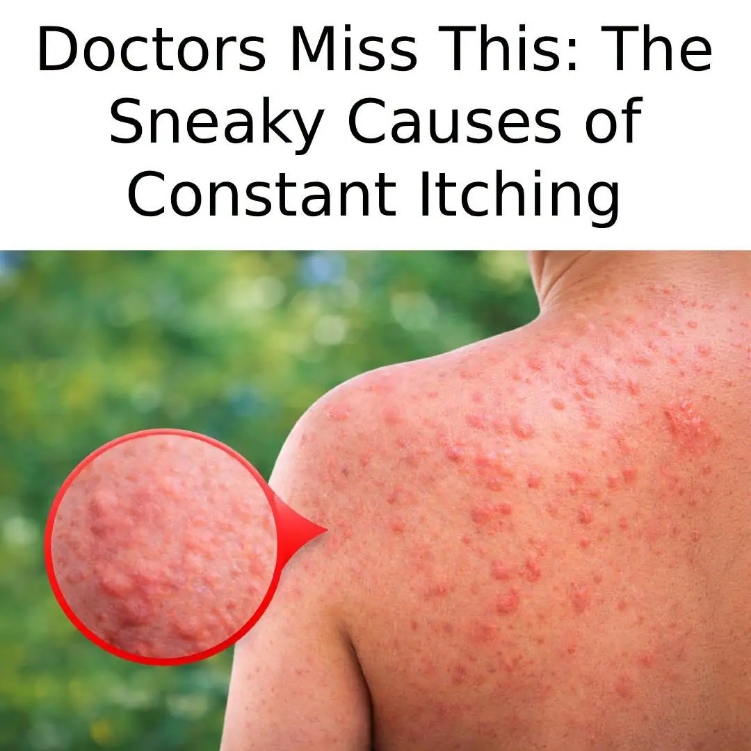 Itching All Over the Body – Causes and Natural Treatments