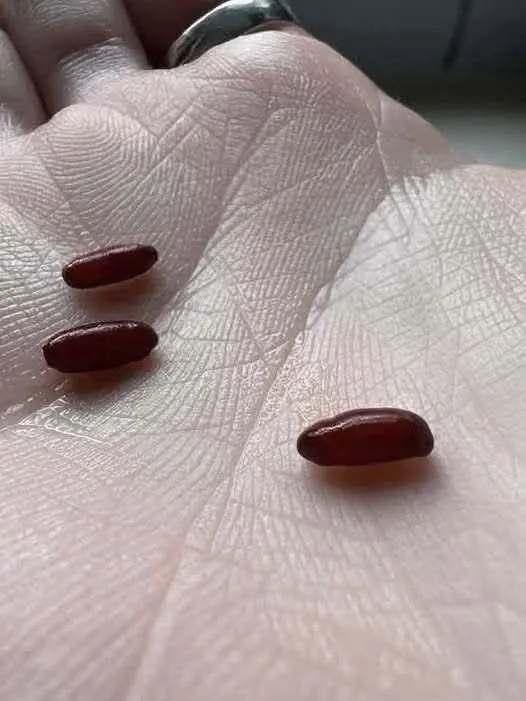 A Family's Warning After a Sudden, Devastating Tick-Borne Illness