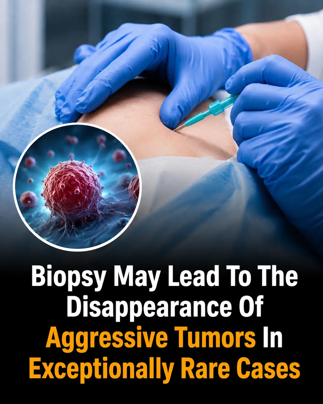Doctors Left Stunned After Woman’s Deadly Tumor Vanished Days After Biopsy