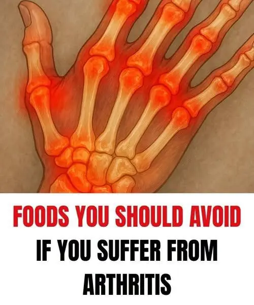 Avoid These Foods to Help Prevent and Relieve Arthritis Discomfort
