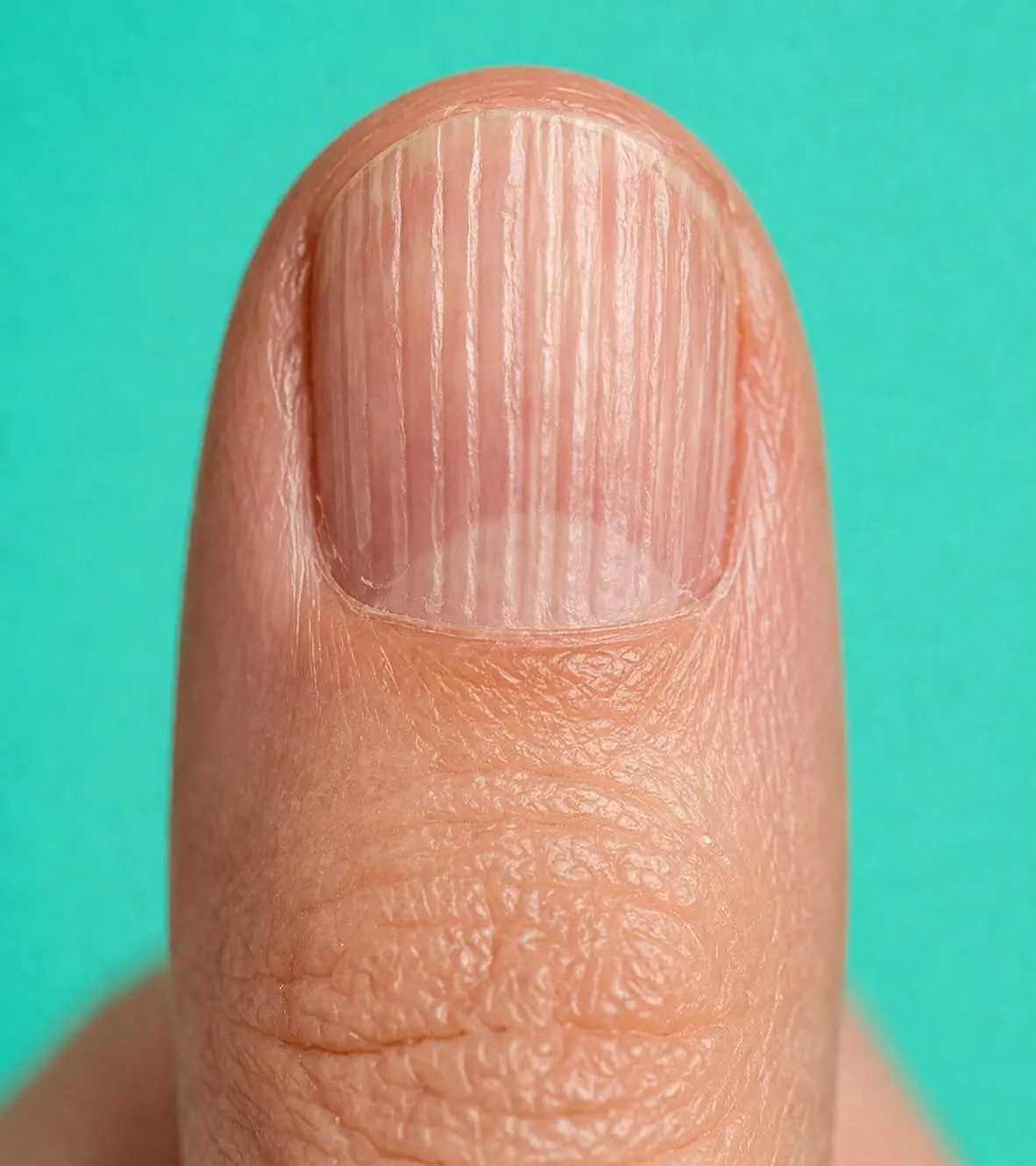 11 Health Warnings Your Fingernails May Be Sending