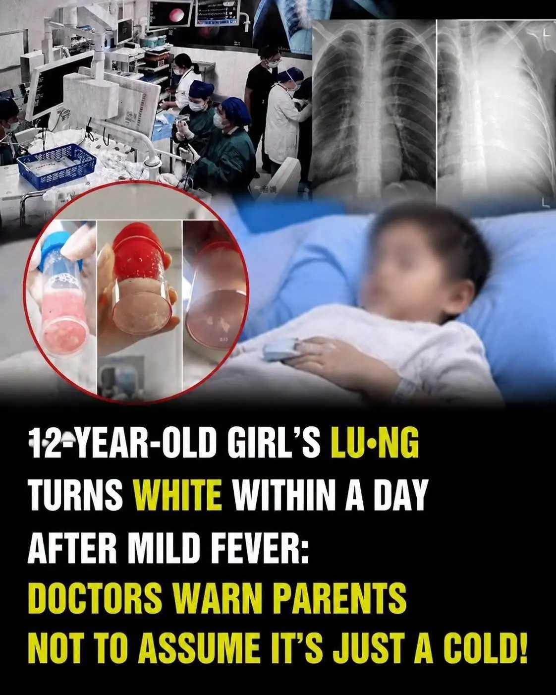 This frightening case shows how quickly a child's condition can deteriorate
