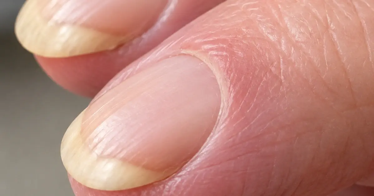 My dad's fingertips have become really round and the nails are curving over the edge. Why is this happening to him?