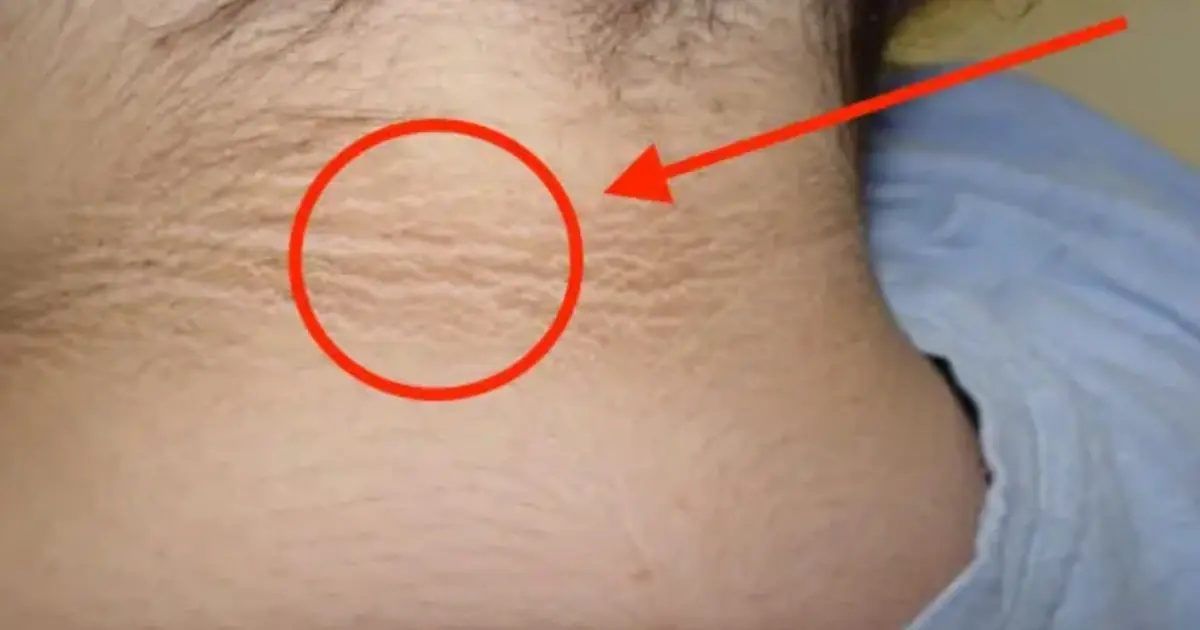 12 weird diabetes skin problems you need to know