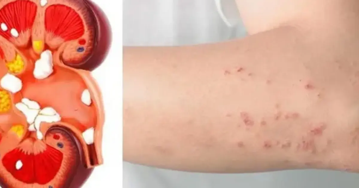 The Body Will Give You These 10 Signs If Your Kidney Is In Danger