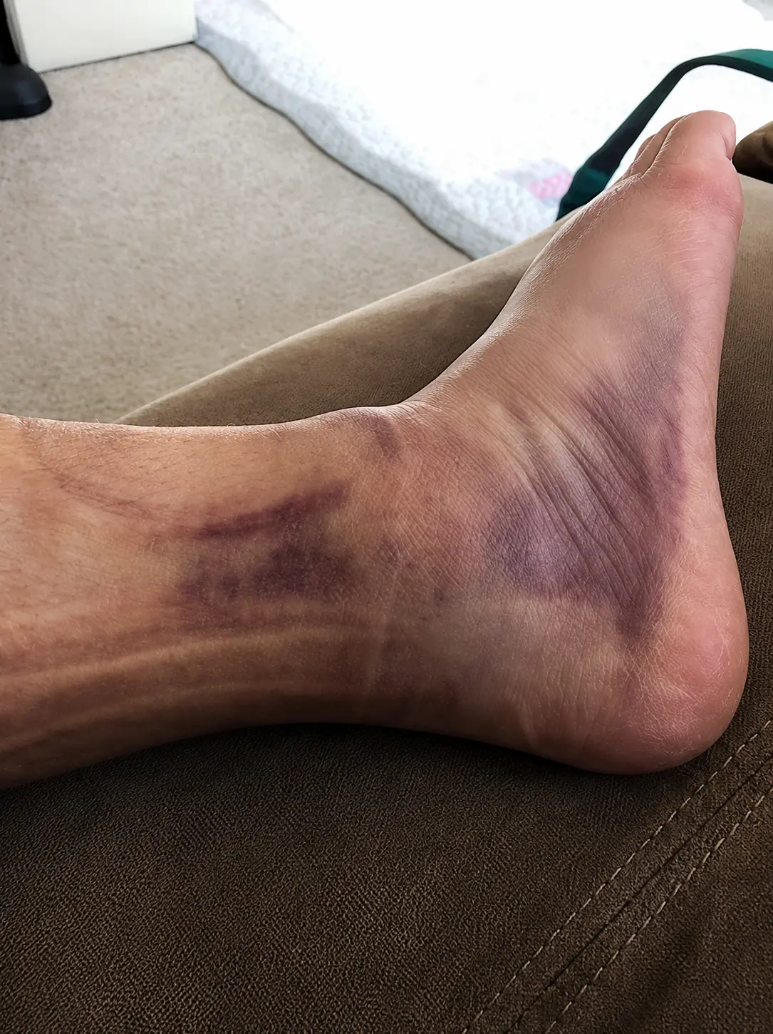These are the consequences of wearing… See more
