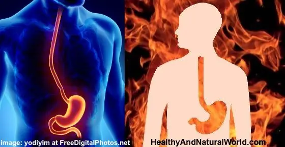Proven Home Remedies for Heartburn (Acid Reflux) & Natural Antacids