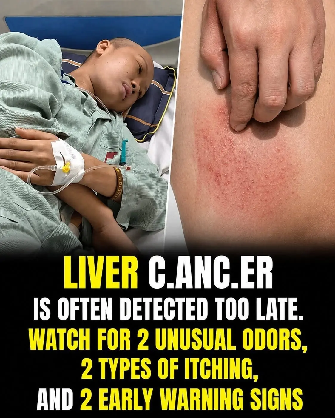 Liver Cancer: Early Warning Signs You Should Never Ignore