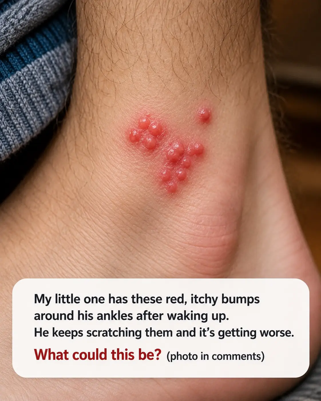 My toddler woke up with these tiny red bumps clustered all around his ankles. The nurse line is completely busy and he keeps scratching them. What is this?