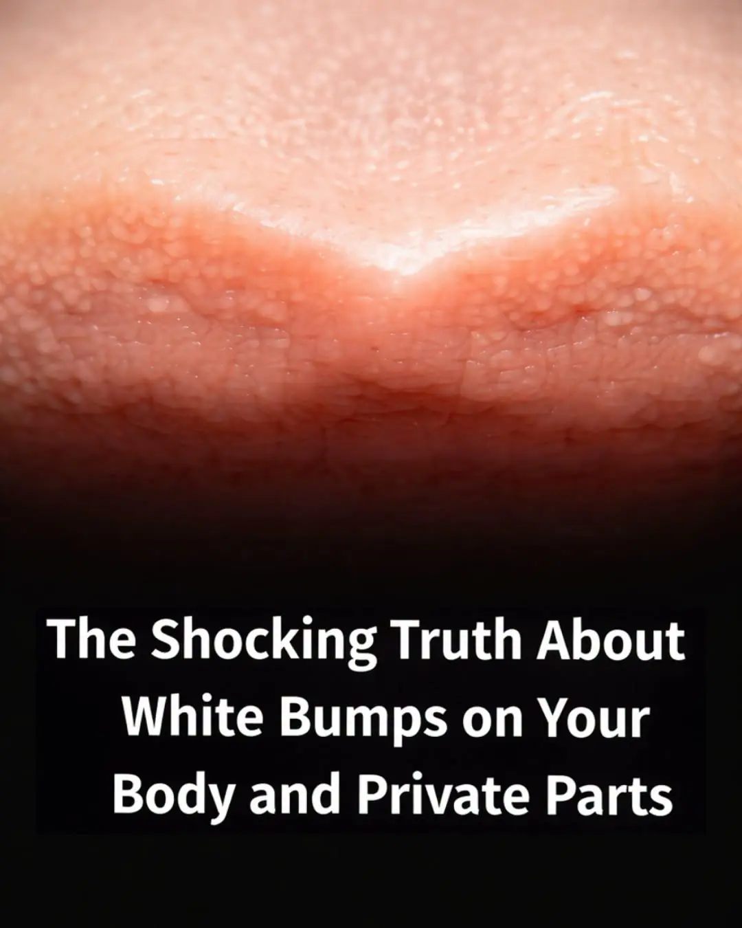 White Bumps or Spots on Lips: Causes and Effective Treatments