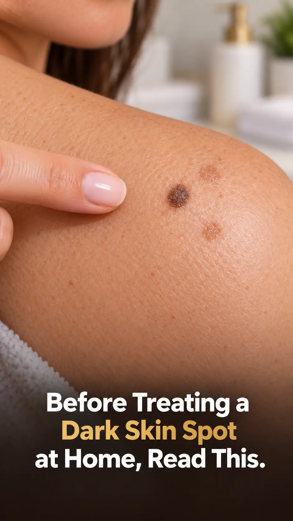 Before Trying to Remove a Mole or Raised Bump at Home, Read This