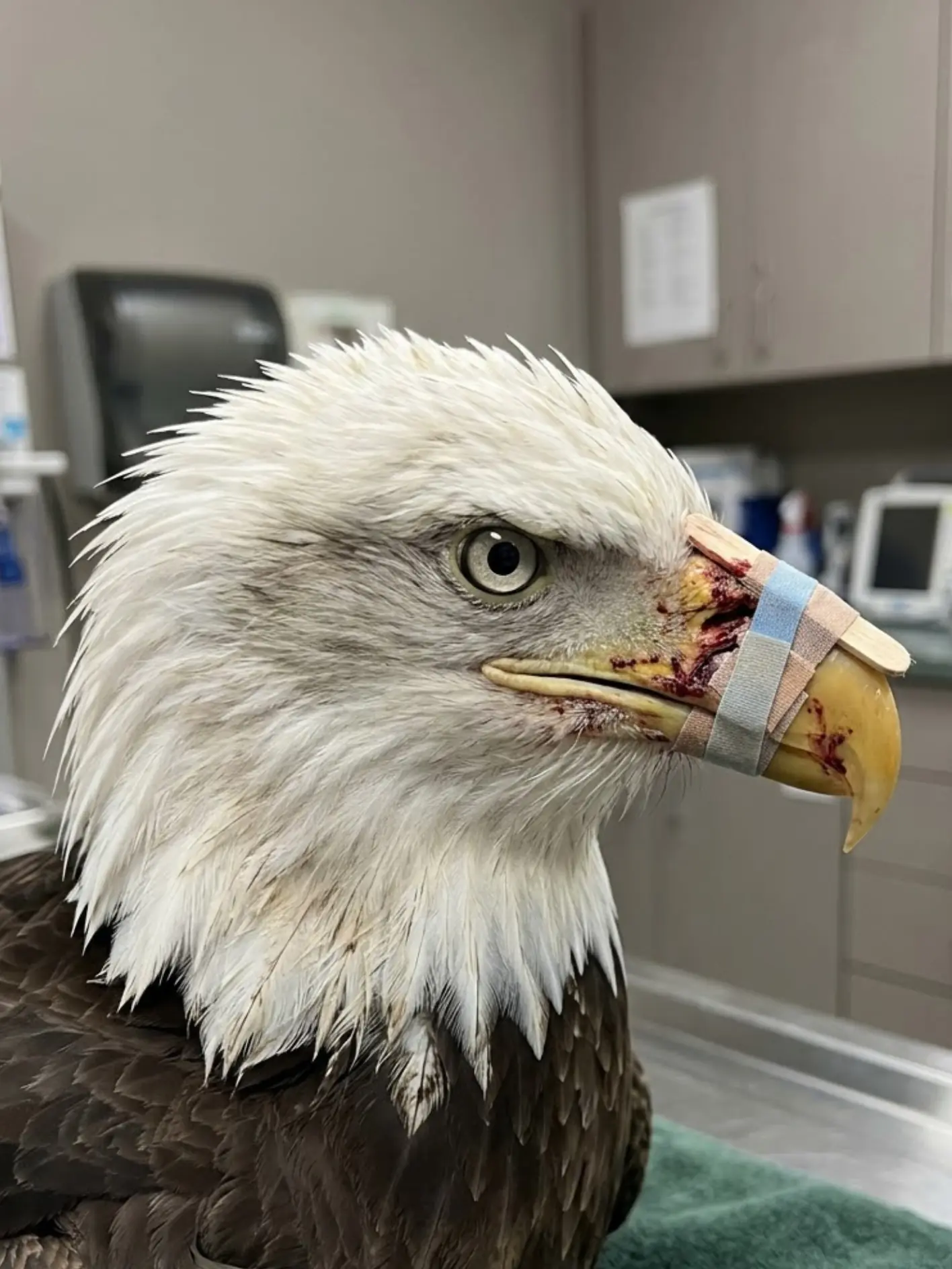 Bald Eagle Found With Its Beak Shattered by Gunfire — A Temporary Beak Brace May Be Its Only Path Back to the Wild.