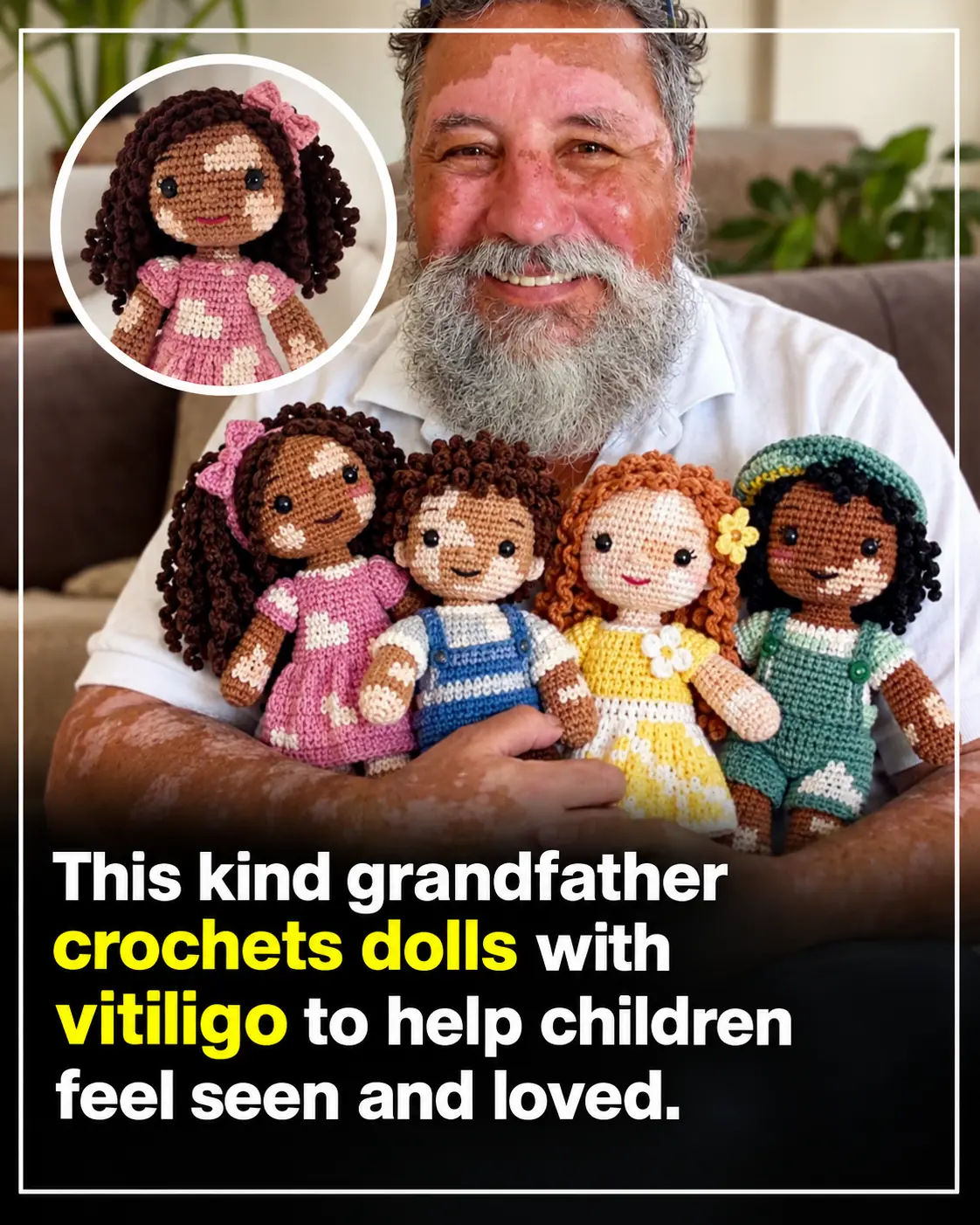 He Crocheted a Doll With Vitiligo for His Granddaughter—Then Changed Lives Around the World
