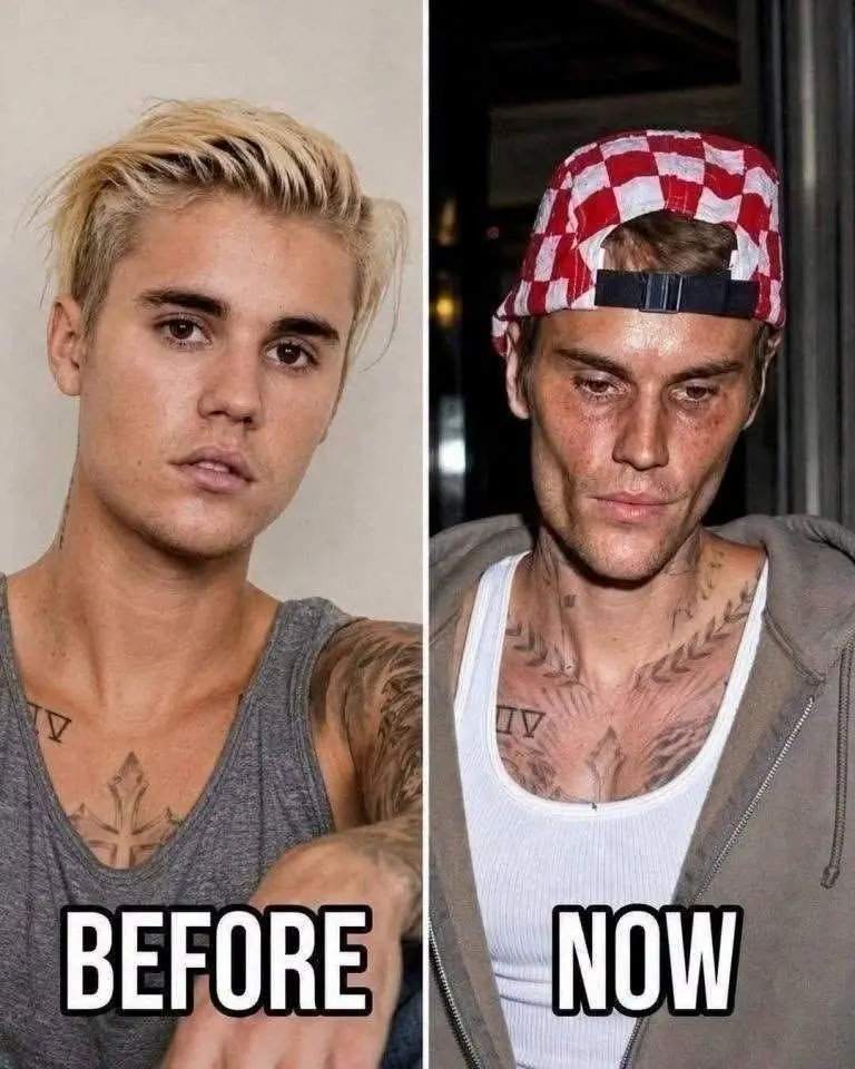 Justin Bieber admits that he tested positive for…See more