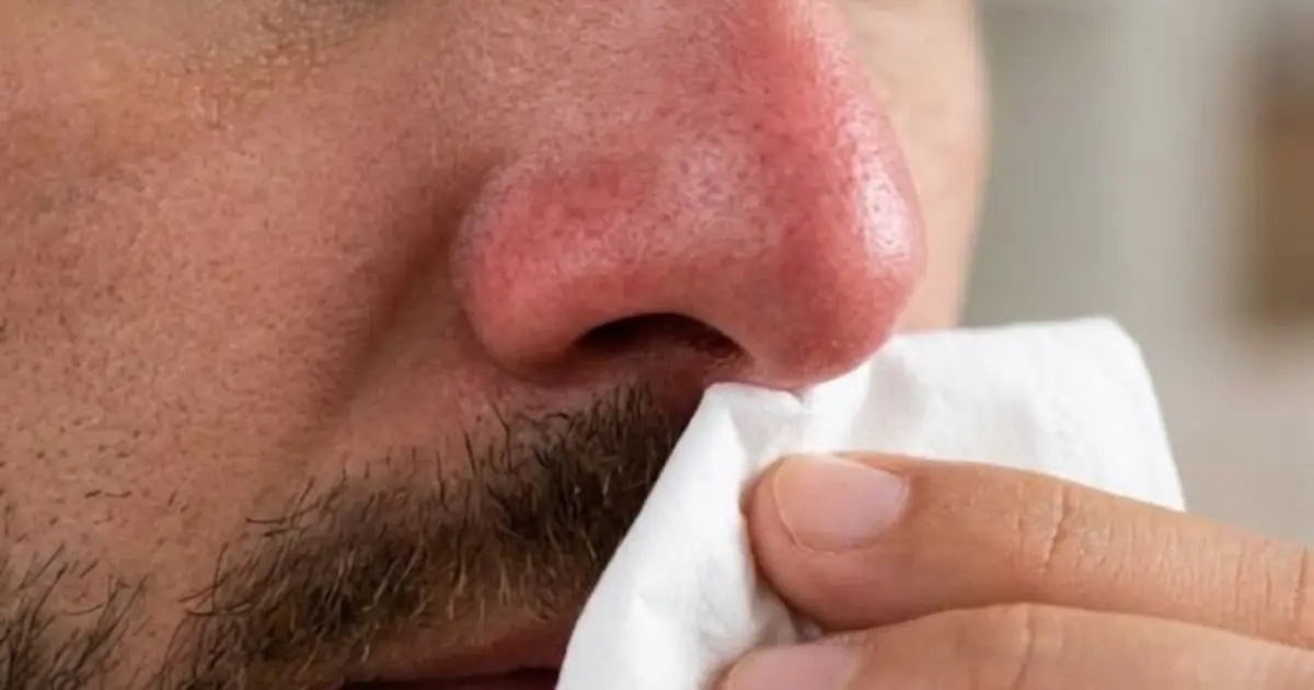 Why Your Nose Keeps Running Indoors During Winter Even When You Aren’t Sick: 12 Possible Causes and What Really Helps